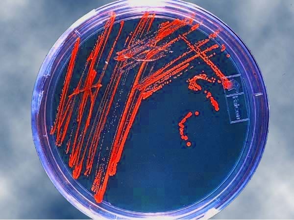 Petri dish with bacterial colonies