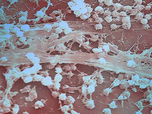 S. aureus biofilm colorized